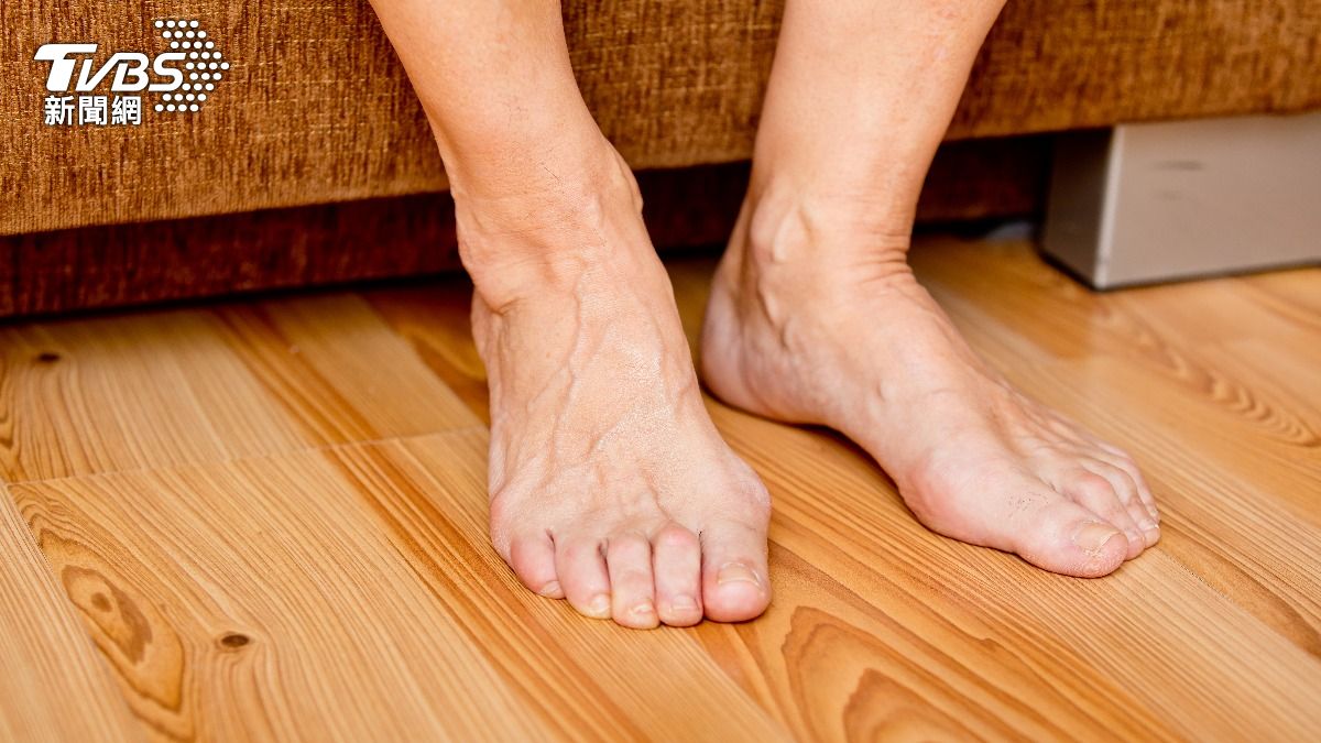 下肢周邊動脈阻塞可以依照症狀區分成不同的嚴重程度。（示意圖／shutterstock達志影像） 